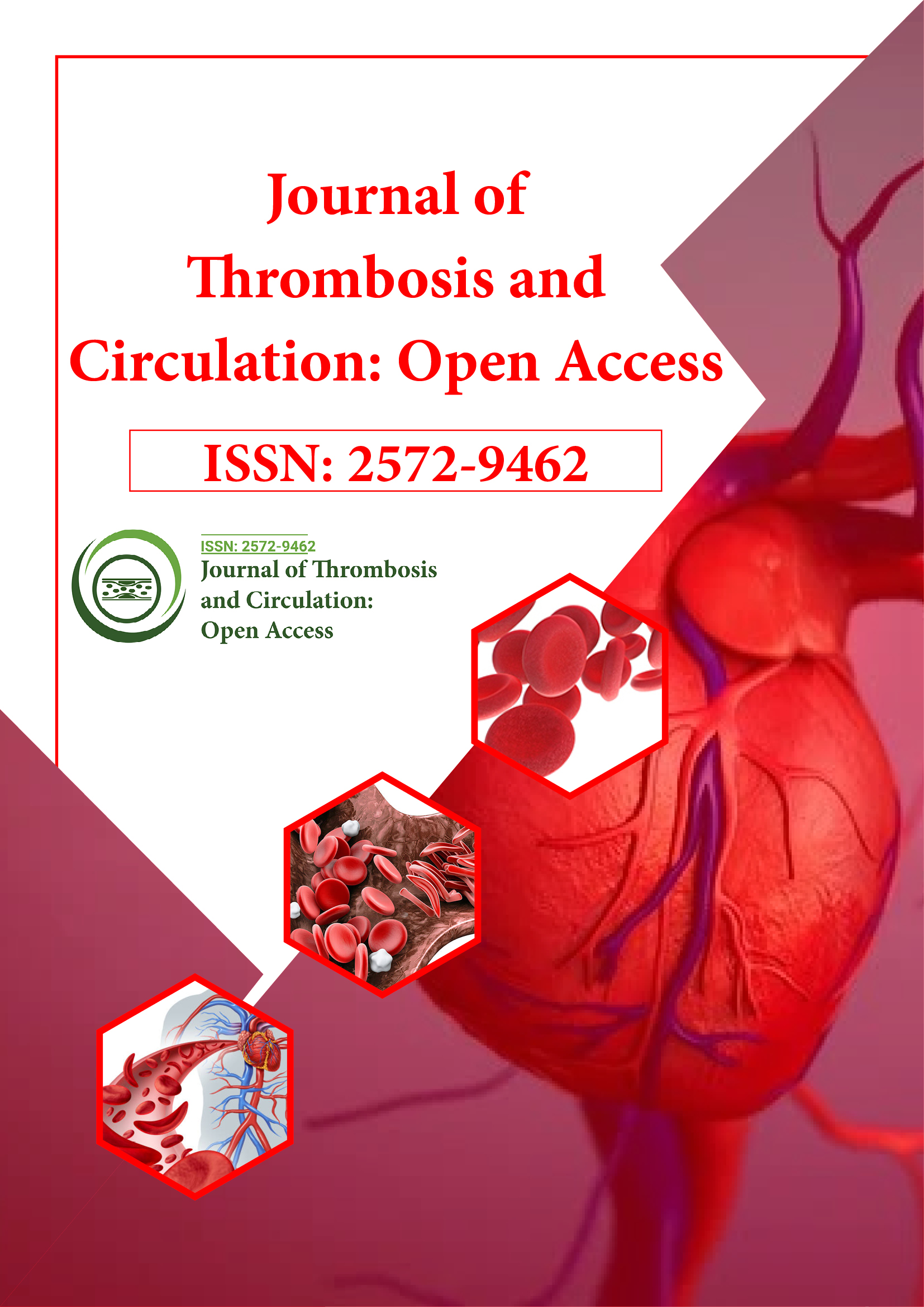 Journal of Thrombosis and Circulation: Open Access