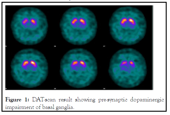 aging-science-dopaminergic