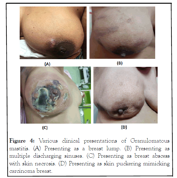 aging-science-lump