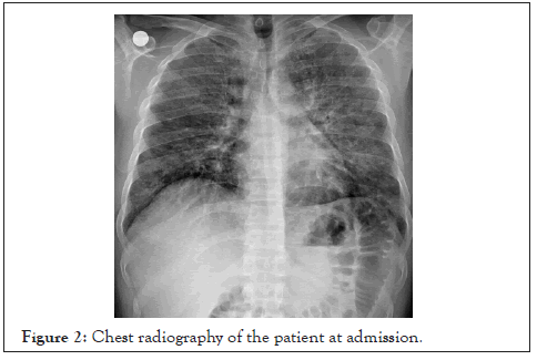 bacteriology-parasitology-patient