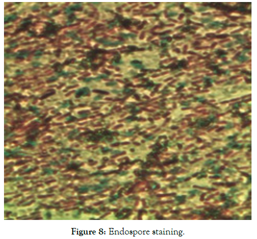 biomolecular-research-therapeutics-endospore-staining