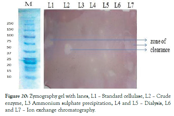 biomolecular-research-therapeutics-zymography