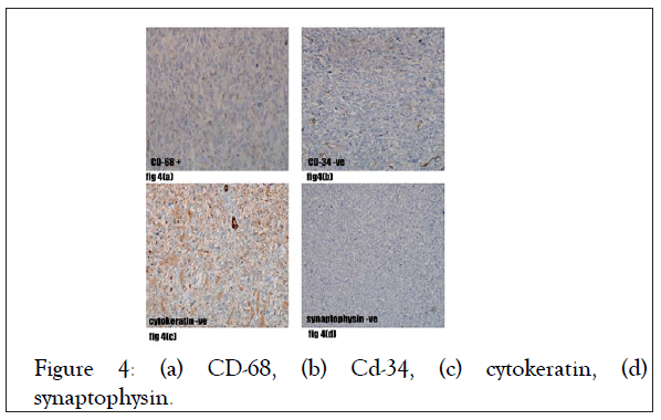 cytokeratin