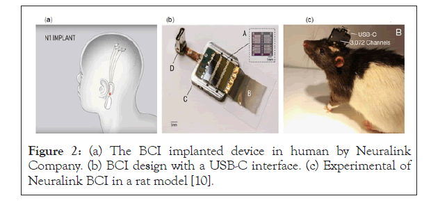 clinical-research-Neuralink