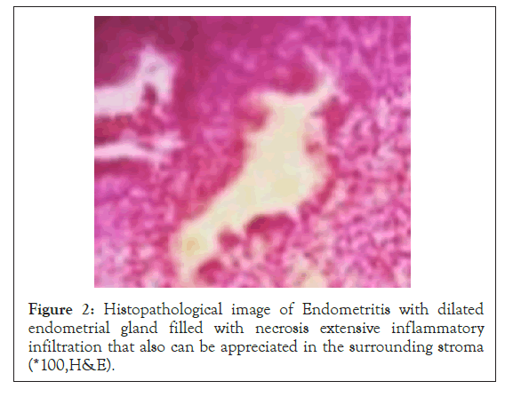 Histopathological