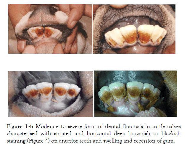 global-journal-biology-agriculture-health-sciences-fluorosis