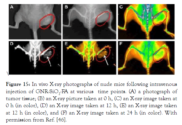 nanomedicine-nanotechnology-intravenous