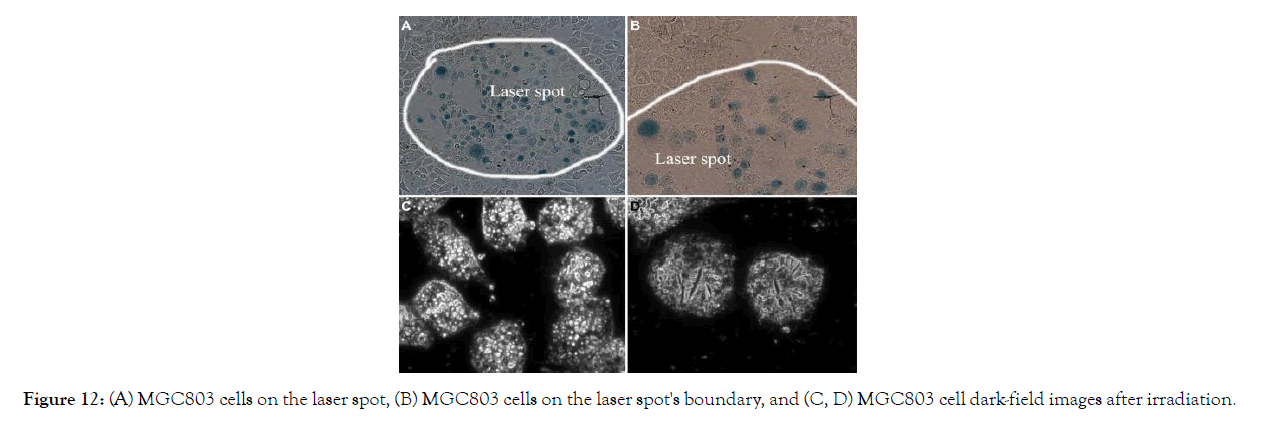 nanomedicine-nanotechnology-laser