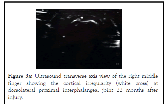 pain-management-axis