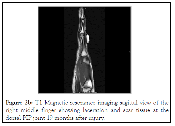 pain-management-sagittal