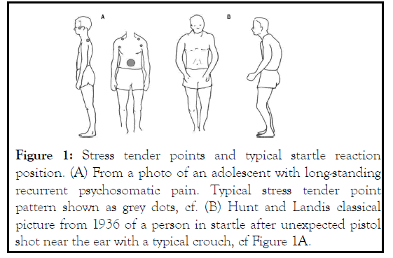 pain-management-tender