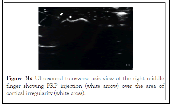 pain-management-transverse