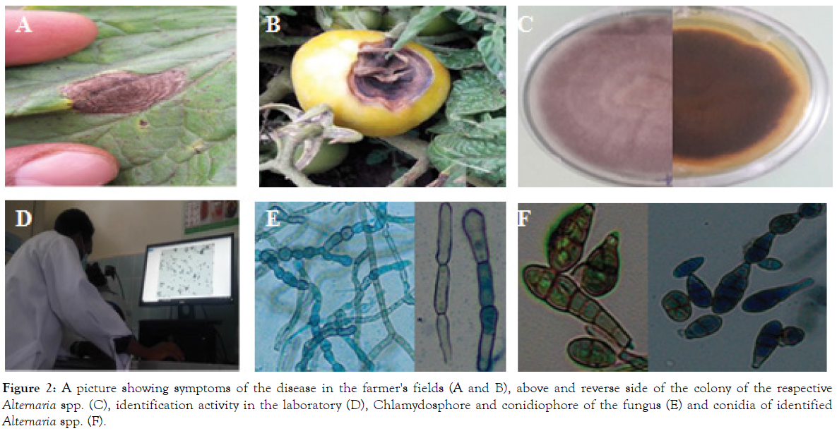 plant-pathology-microbiology-chlamydosphore