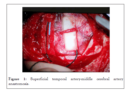 surgery-anesthesia