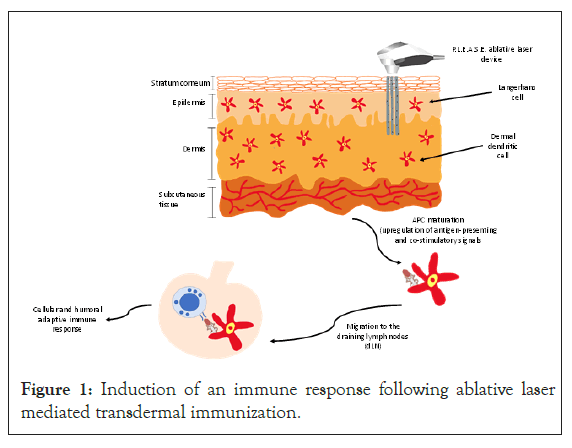 vaccines-vaccination-immune