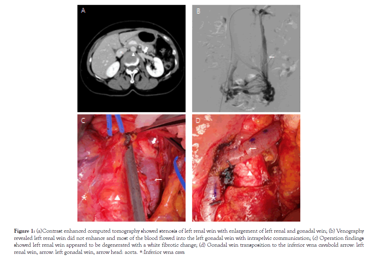 vascular-medicine-Venography