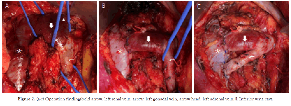 vascular-medicine-adrena