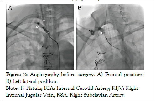 vascular-medicine-angiography