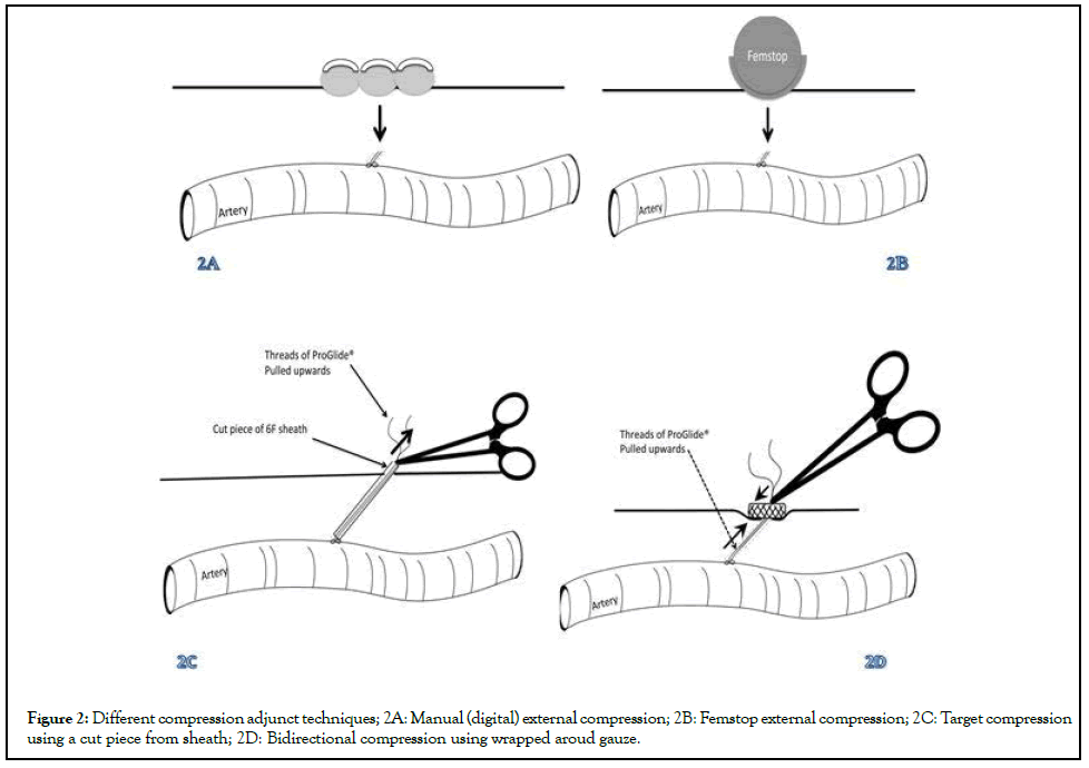 vascular-medicine-compression