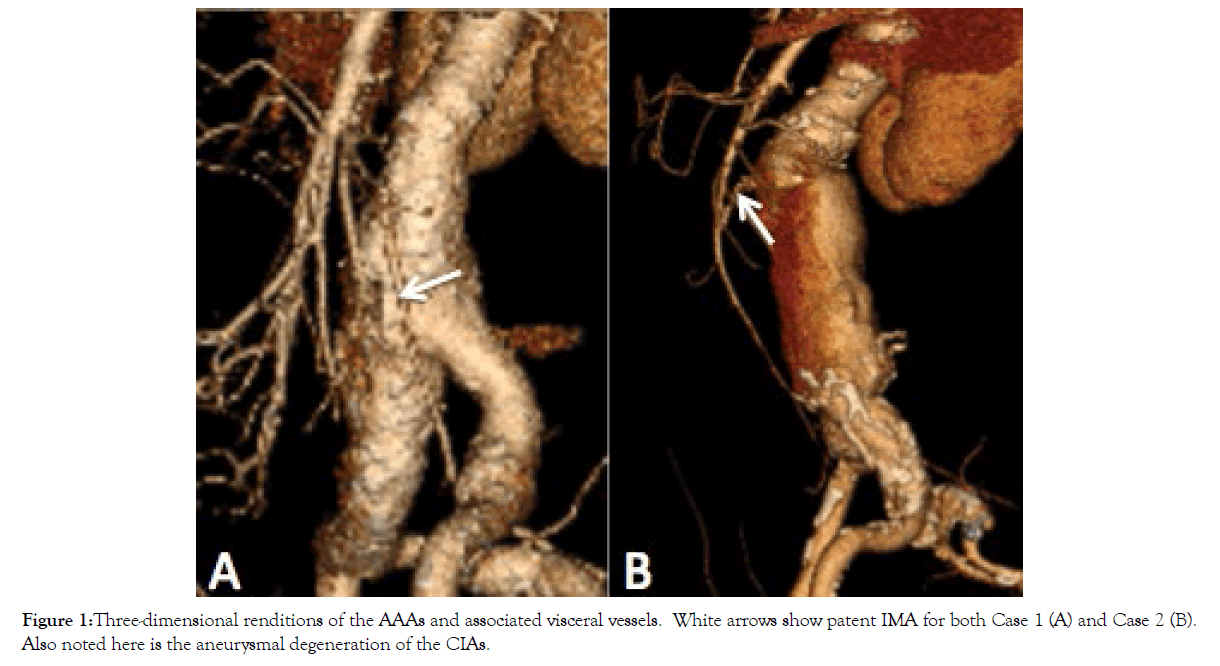 vascular-medicine-visceral