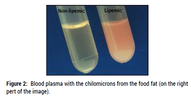 diabetes-metabolism-plasma