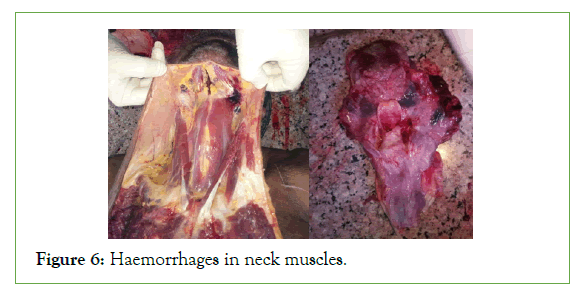 forensic-haemorrhages