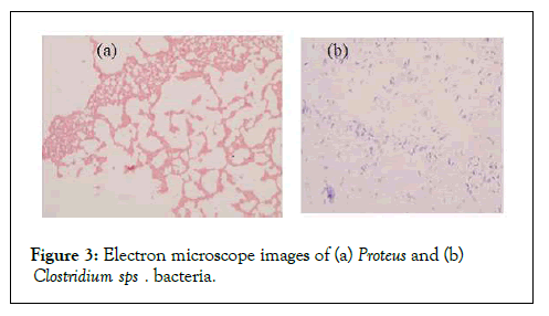 microbial-Electron