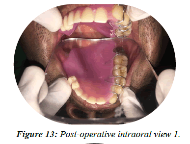oral-health-intraoral