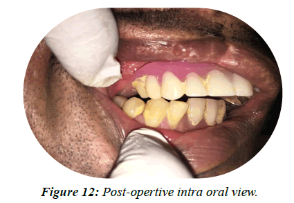 oral-health-oral