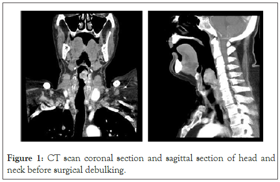 surgery-anesthesia-coronal