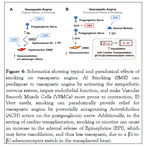 vascular-medicine-vasospasm