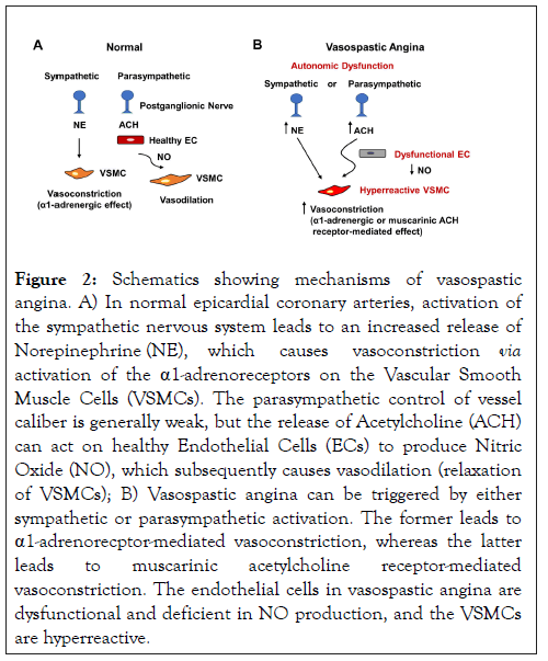 vascular-medicine-vasospastic