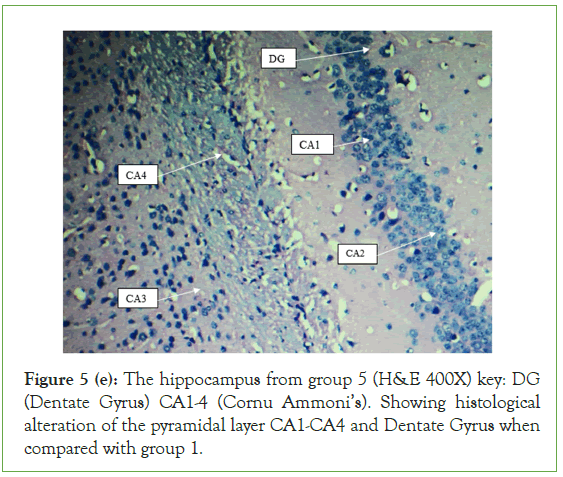 Clinical-Cornu