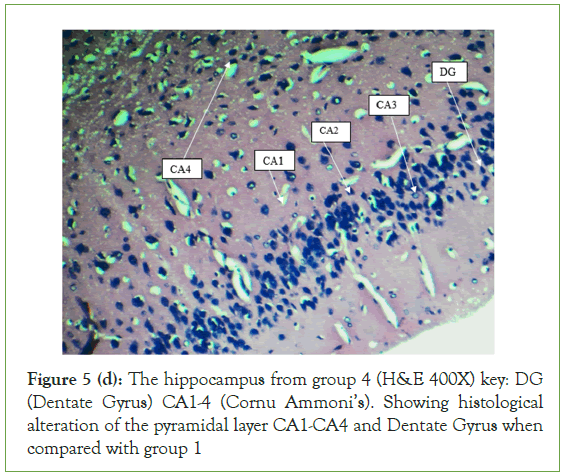 Clinical-Gyrus