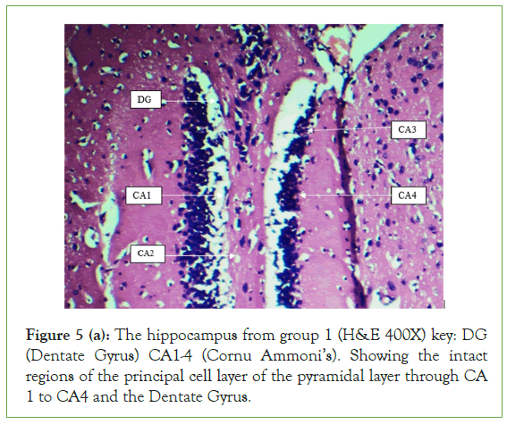 Clinical-hippocampus