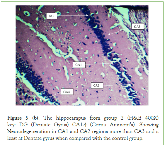 Clinical-hippocampus