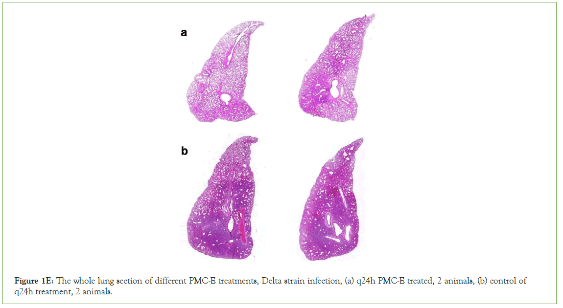 Clinical-lung