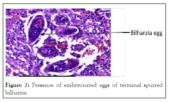 Clinics-embryonated