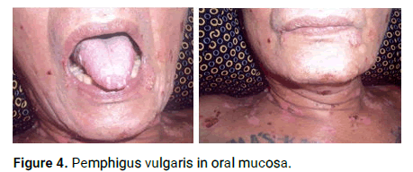 DMCR-oral