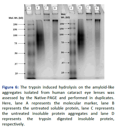 Eye-Cataract-trypsin