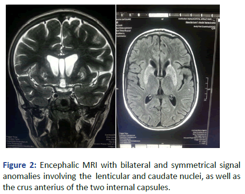 Pediatric-Dermatology-Encephalic