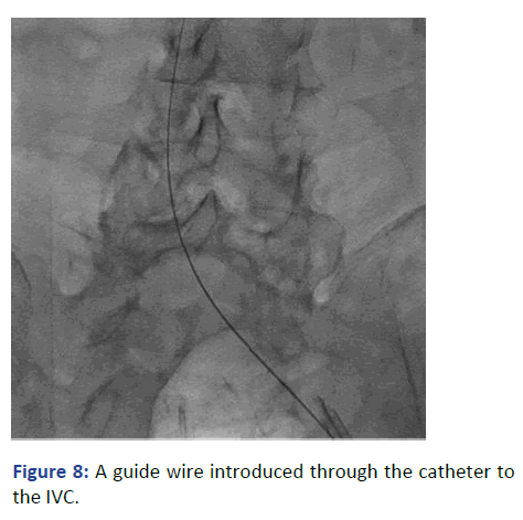 Imaging-Radiology-IVC