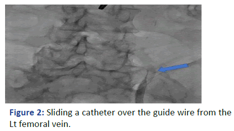 Imaging-Radiology-Sliding