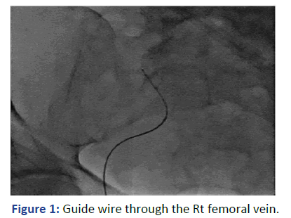 Imaging-Radiology-femoral