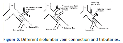 Imaging-Radiology-iliolumbar