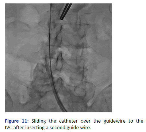 Imaging-Radiology-inserting