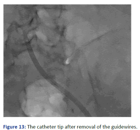 Imaging-Radiology-removal