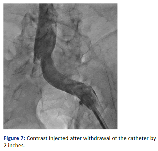 Imaging-Radiology-withdrawal