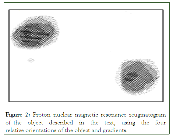 MCA-Proton