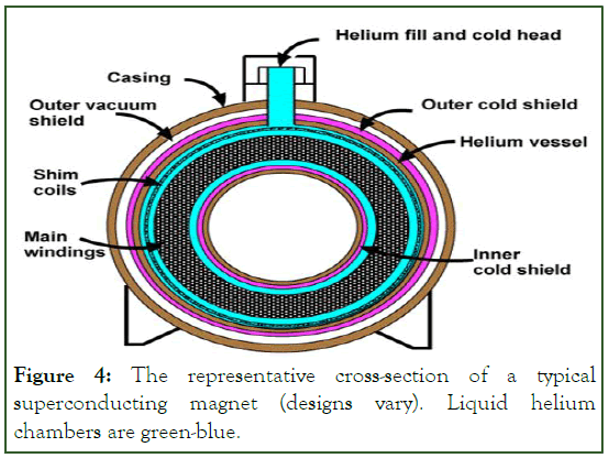 Superconductive magnet design - Questions and Answers ​in MRI